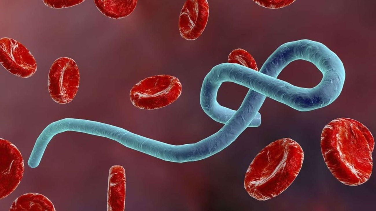إيبولا يتفشى في الكونغو… ومنظمة الصحة العالمية تحذر من سرعة انتشاره