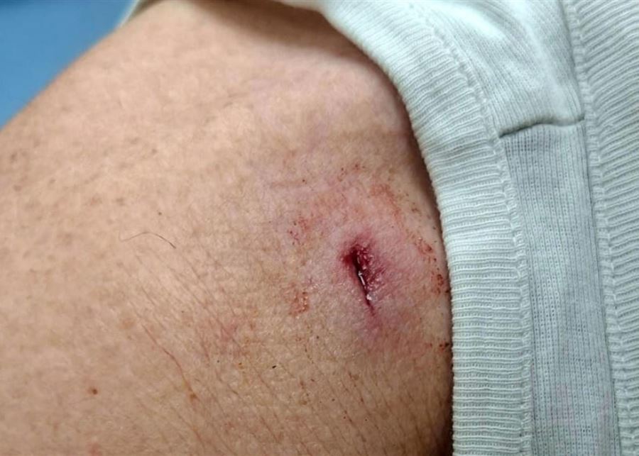 في جسر الباشا... إصابة مواطن برصاصة خلال تشييع في الضاحية